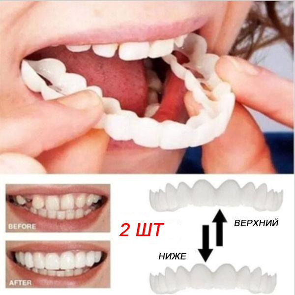 Reusable Snap-On Veneers for a Perfect Smile