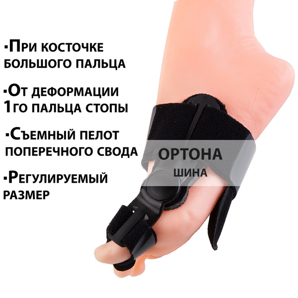 Hallux Valgus Bunion Corrector: Day & Night Adjustable Splint