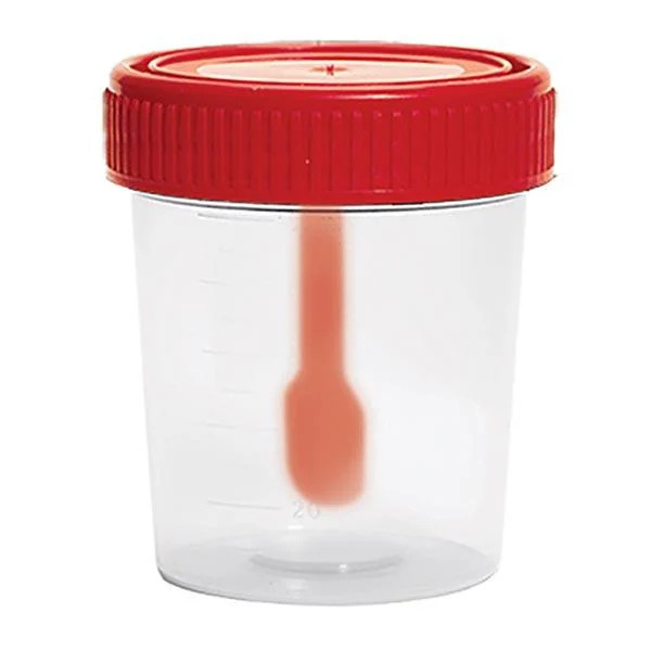 Sterile Sample Container with Spoon (60ml, 15 Pack)
