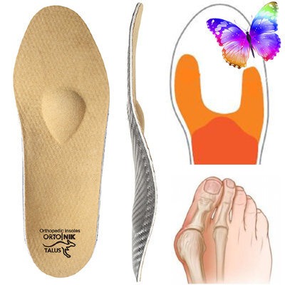 Bunion Relief: Orthotic Inserts for Hallux Valgus Correction
