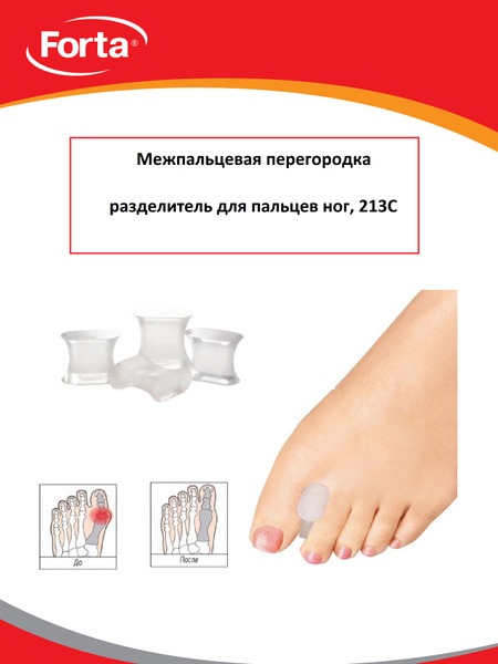 FORTA 213C Toe Separators: 1.5cm Thick Bunion Corrector (2 Pack)