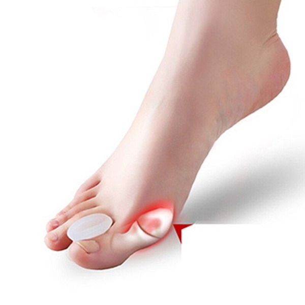 Toe Separator & Bunion Corrector: Hallux Valgus Relief (Sizes 38-45)