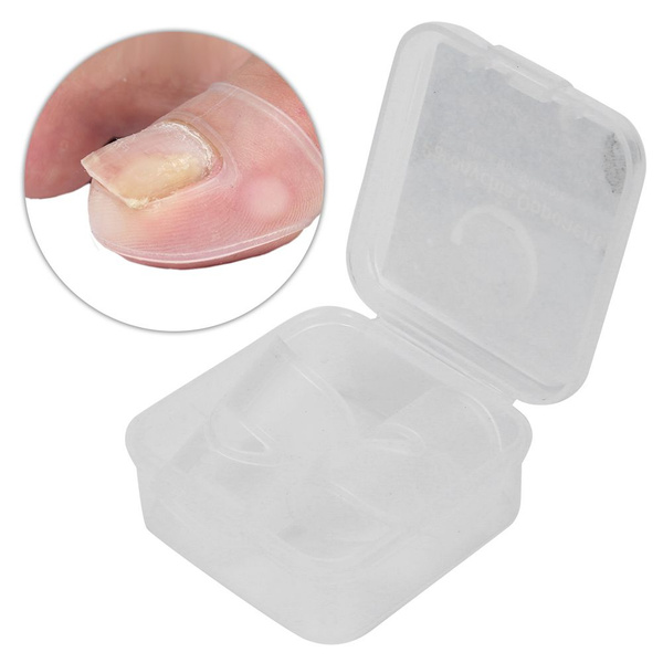 Ingrown Toenail Corrector
