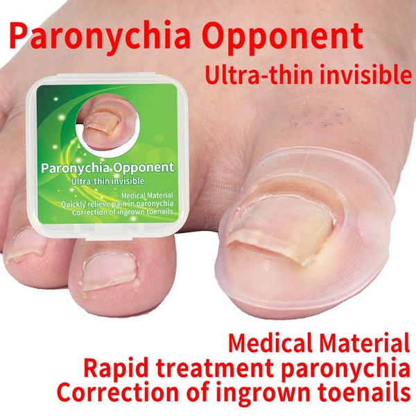 Invisible Ingrown Toenail Silicone Corrector