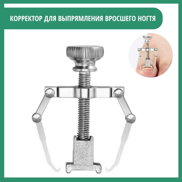 Ingrown Toenail Corrector: Home Treatment