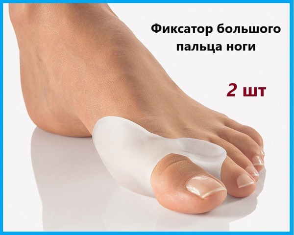 Hallux Valgus Bunion Corrector with Interdigital Separator: Foot Pain Relief