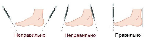 Health Art Orthotic Insoles: Sizes 24.5-40 (incl. Gold, L)
