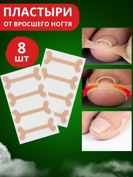 Ingrown Toenail Patches: Pain Relief and Correction