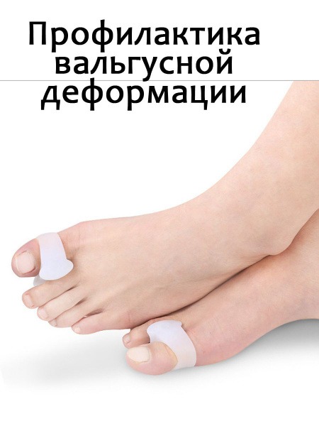 Silicone Inserts for Hallux Valgus Correction