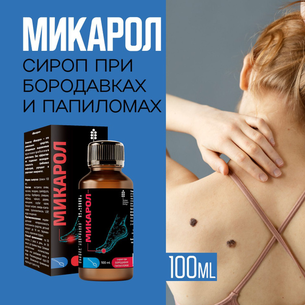 Mikarol Syrup: Wart & Papilloma Removal