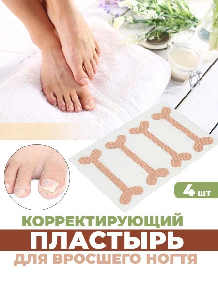 Ingrown Toenail Corrector Patches: 4-Pack for Pain Relief and Healing