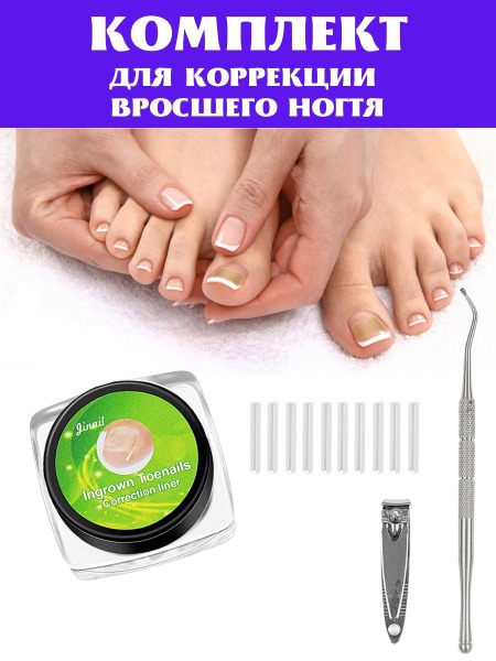 Ingrown Toenail Corrector Kit: Fix Your Ingrown Nail at Home