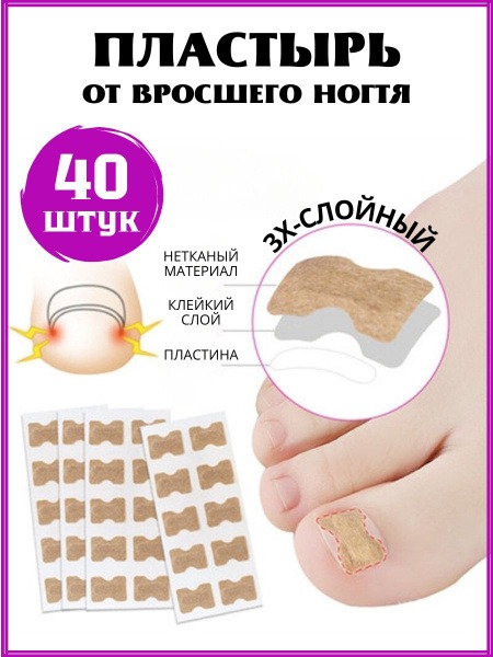 Ingrown Toenail Corrector: 40-Piece Home Kit for Fast Relief