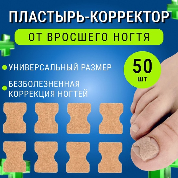 Ingrown Toenail Corrector Patches (50 Count)