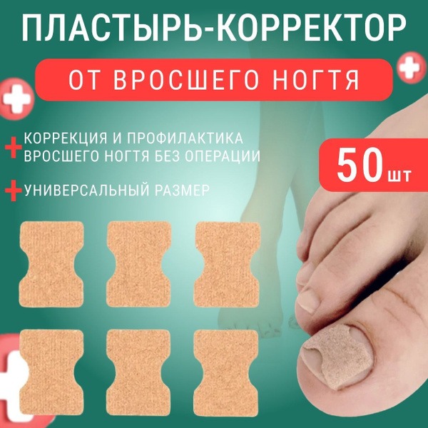 Ingrown Toenail Patch: Kopoplin Pain Relief