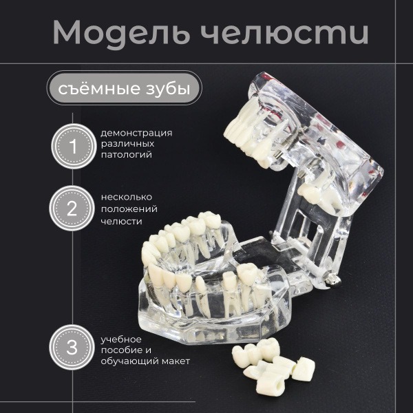 Dental Jaw Model with Pathologies