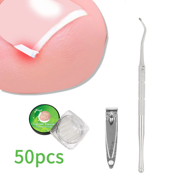 Ingrown Toenail Treatment Kit: 3-in-1 Thick Toenail Solution