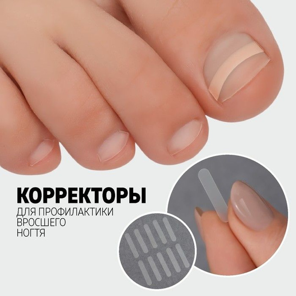 Ingrown Toenail Stickers (10 Count, White)