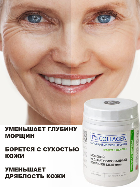 Marine Collagen Powder: 100 Servings