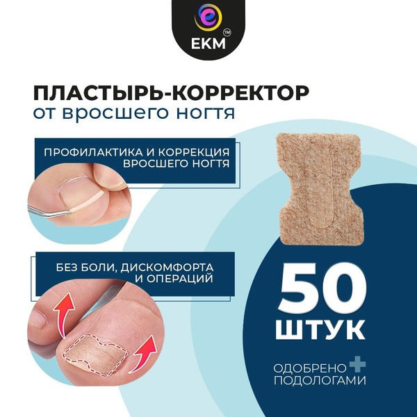 Ingrown Toenail Corrector Patches (50 Pack) - EKMPodology