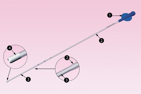 Embryo Transfer Catheter: Easy & Efficient
