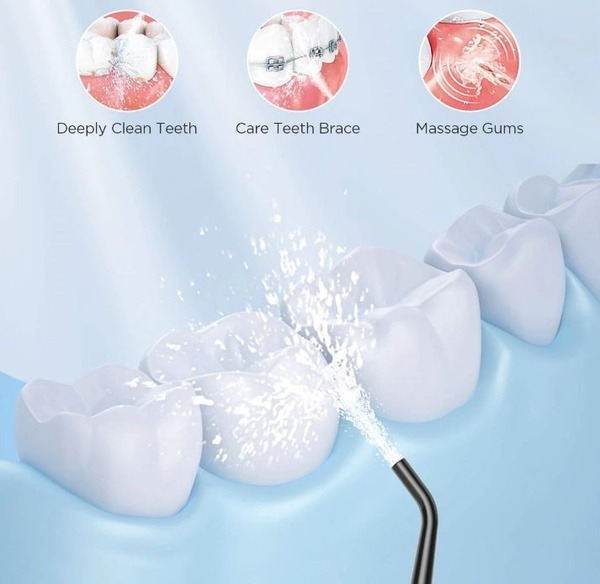 Water Flosser Tips