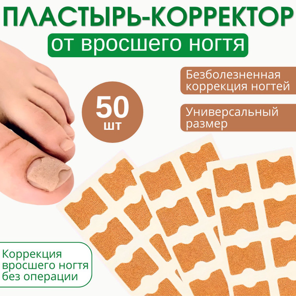 Ingrown Toenail Patch: Corrective Treatment & Prevention