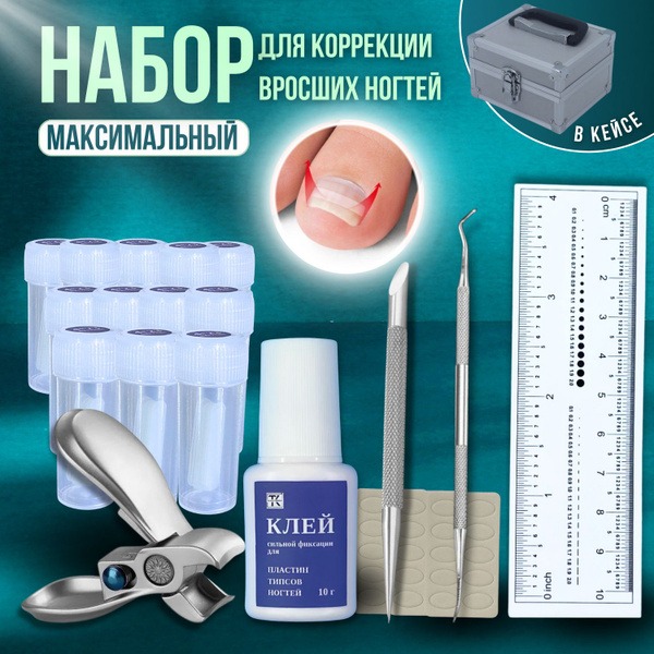 Ingrown Toenail Correction Plate System: Maximum Strength