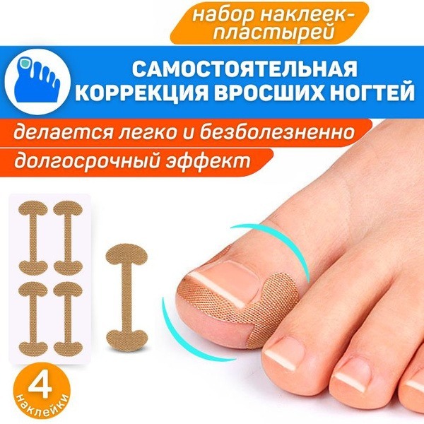 Ingrown Toenail Correction Kit: 4-Piece Lift & Repair System