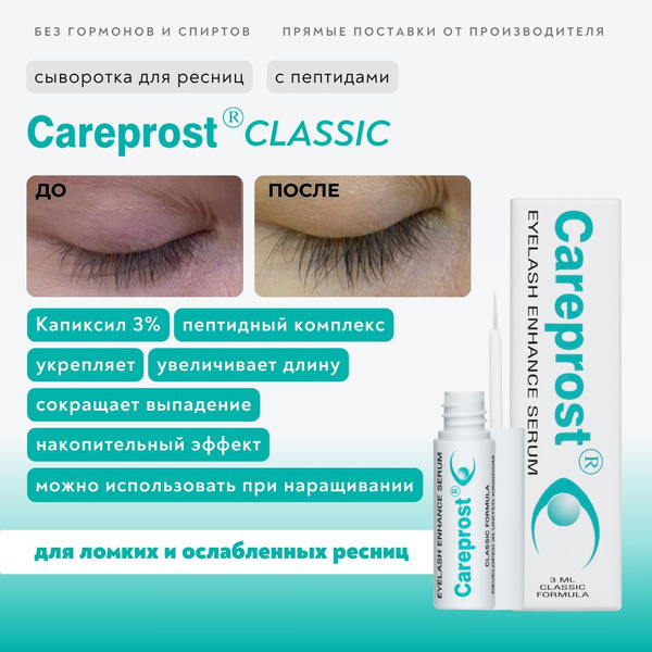 Careprost Classic Lash Serum: 3% Capixyl Peptide Growth Formula