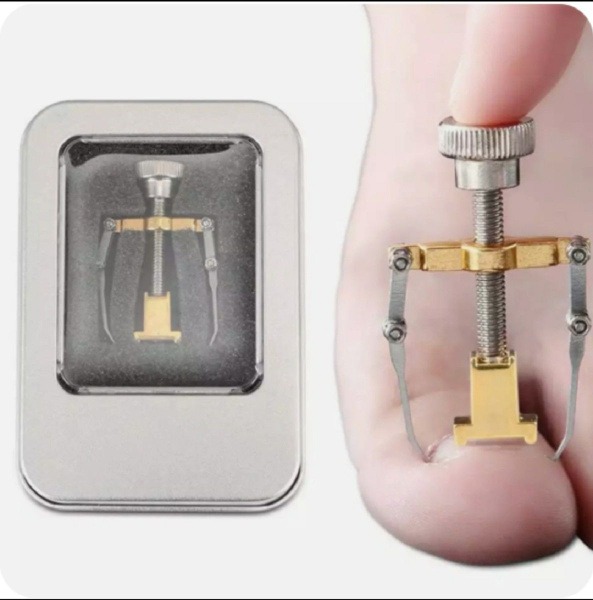 Ingrown Toenail Treatment Tool