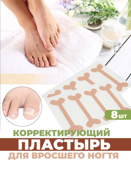 Ingrown Toenail Patch: Corrective Treatment