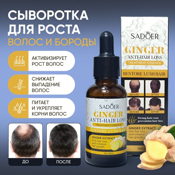 Sadoer Ginger Hair Growth Serum: Stops Hair Loss & Balding