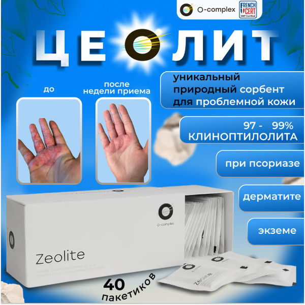 Zeolites for Psoriasis, Dermatitis, Eczema & Clear Skin: Detox & O-Complex Benefits