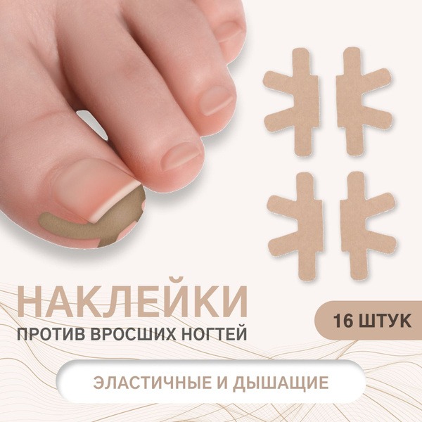 Ingrown Toenail Correction Stickers (16 Pack, Beige)