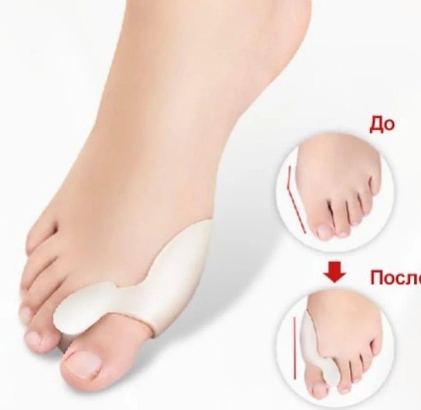 Valgus Pro Bunion Corrector: Daytime Support