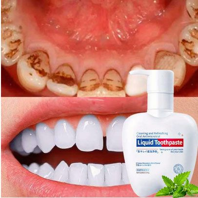 Probiotic Whitening Toothpaste (200g with Pump) - Cool Mint, Enamel Protection