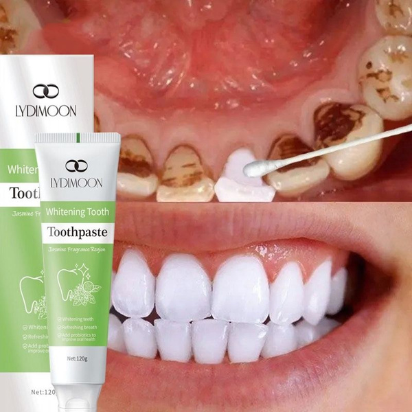 Whitening Toothpaste for Sensitive Teeth & Gum Health (120g)