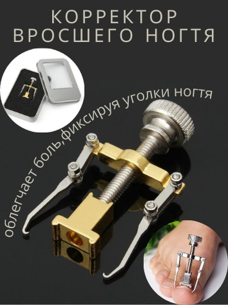 Ingrown Toenail Corrector