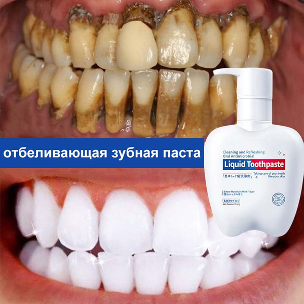 Fluoride-Free Whitening Probiotic Toothpaste for Sensitive Teeth (200g)