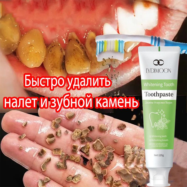 LYDIMOON Whitening Toothpaste: Fluoride-Free, Professional Strength, 120ml