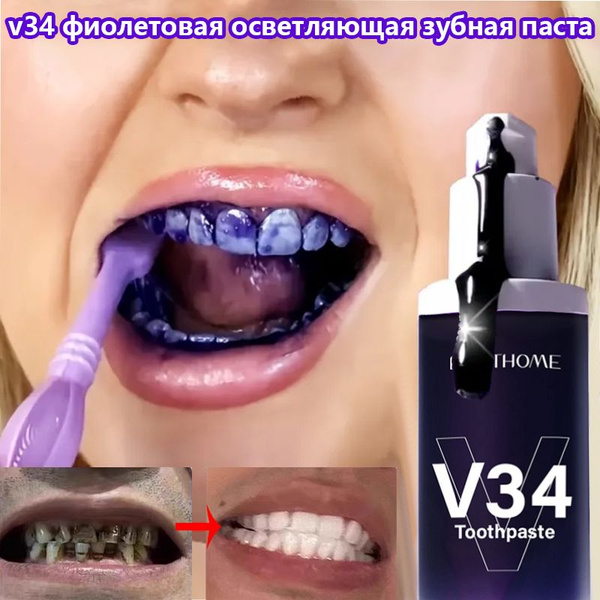 Purple Whitening Toothpaste (30ml): Removes Stains, Freshens Breath
