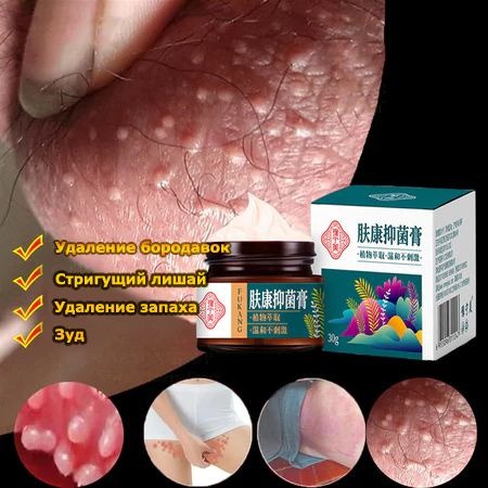 Chinese Herbal Ointment for Psoriasis, Eczema, Herpes, and Acne Relief
