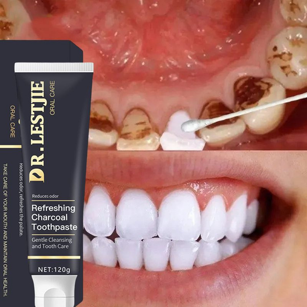 Sensitive Teeth Whitening Toothpaste: Gum Disease Prevention & Effective Whitening (120g)
