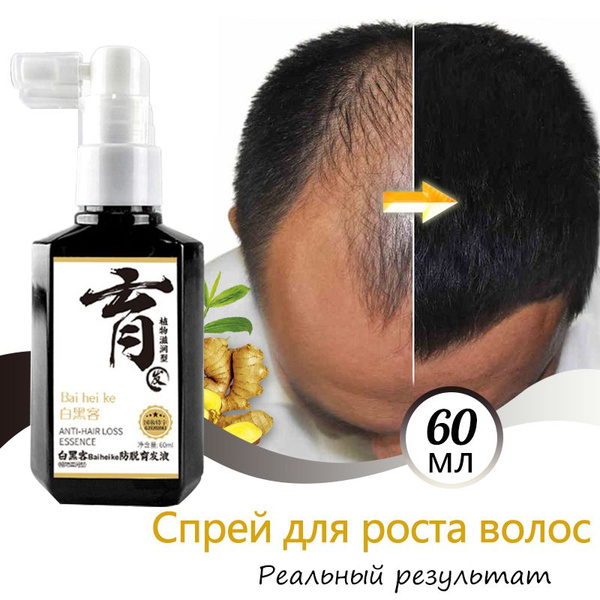 Hair Growth Spray & Anti-Hair Loss Treatment (60ml) - Natural Extracts