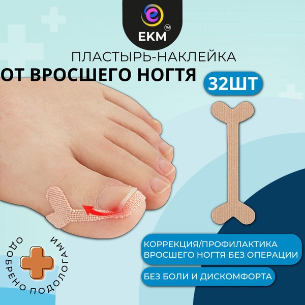 Ingrown Toenail Corrector Patches – EKM Pedicure Kit (32 Patches)