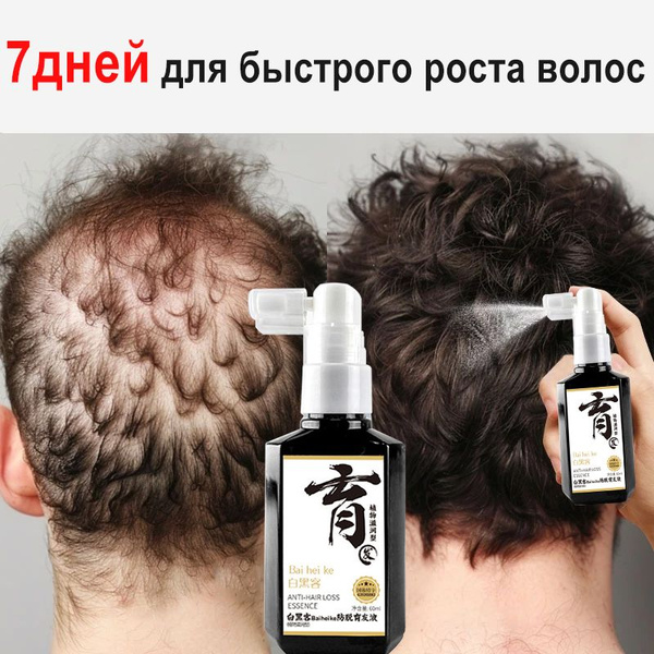 Hair Growth Spray Serum: Stop Hair Loss & Strengthen Hair (60ml)