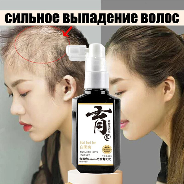 Hair Growth & Thickness Serum: Anti-Hair Loss & Thinning Treatment (60ml)