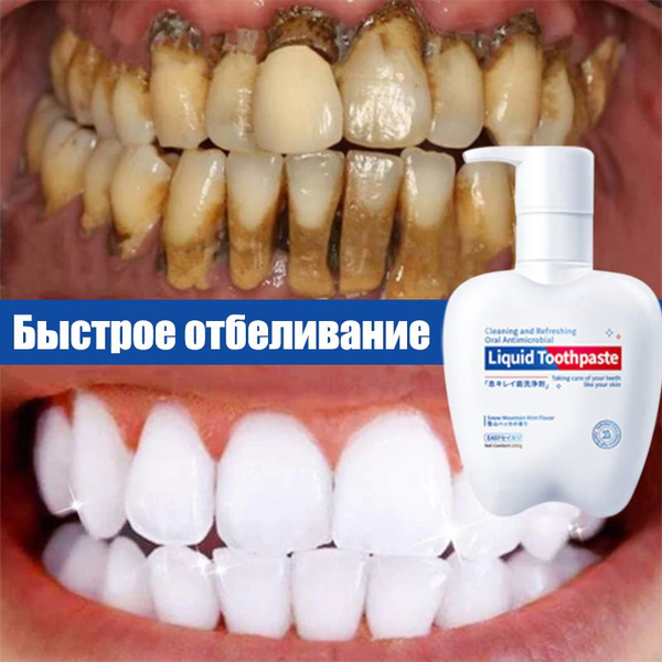 Whitening Toothpaste with Fluoride: Removes Stains from Smoking, Tea & Coffee - Mint, 200g