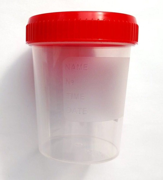 100ml Sample Cups with Measurement Scale (10 Pack) - Non-Sterile